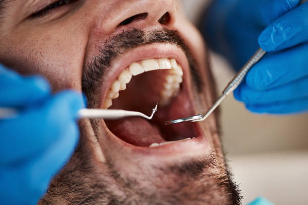 Best Walk-In Emergency Dentist in Paramus, NJ