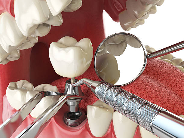 Best Emergency Tooth Extraction in Paramus, NJ